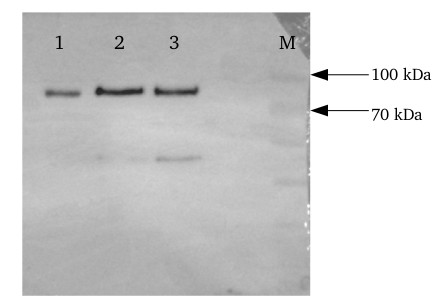 western blot using anti-ACS7 antibodies